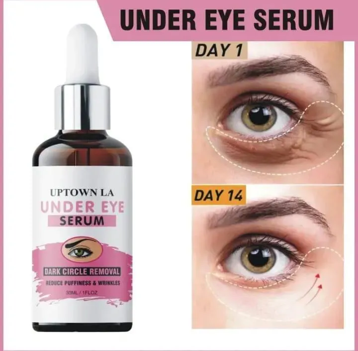 Shop Dark Spots Removal Eye Serum for Acne Prone Skin — PKR 950 ? Online – Fast Delivery